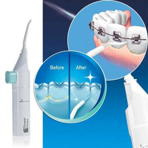  Cleaning braces with irrigator: before and after