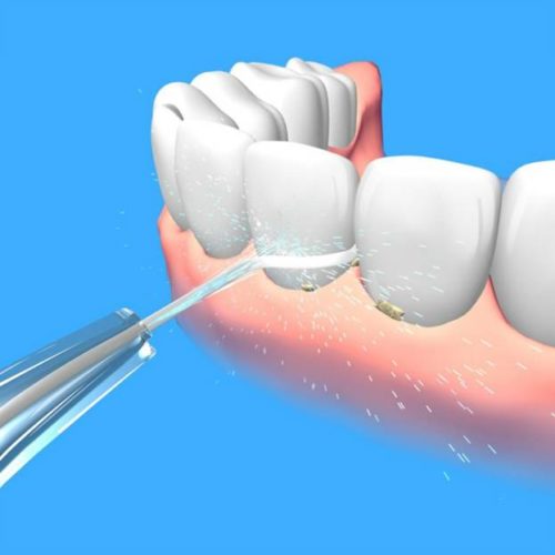  Water pressure on teeth