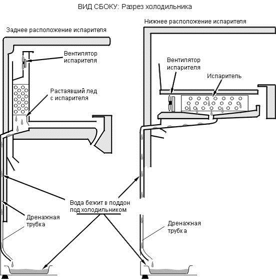  Variants of the location of the drainage tube